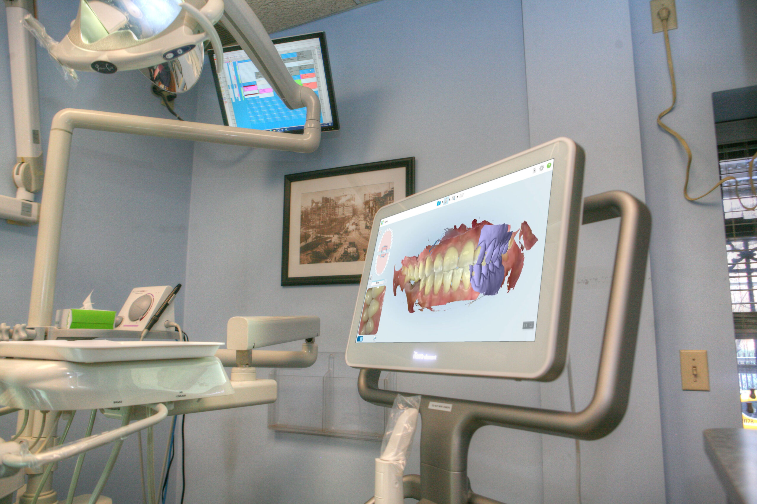 lux smiles nyc dentistry itero scaled 1